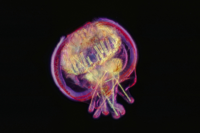 Larve d'Oursin au début de sa métamorphose (Paracentrotus lividus) x25